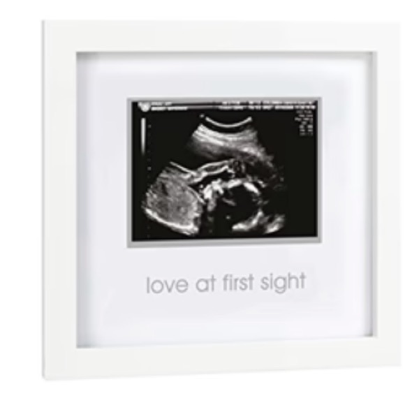 🆕 Pearhead Ultrasound Picture Sonogram Frame “Love at First Sight” - Picture 2 of 7